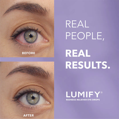 Lumify Redness Reliever Eye Drops 0.08 fl oz Single
